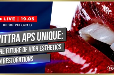 VITTRA-APS-UNIQUE-the-future-of-high-esthetics-in-restorations