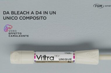 Vittra-APS-Unique-e-un-composito-con-la-capacita-di-adattarsi-a-qualsiasi-colore-dei-denti